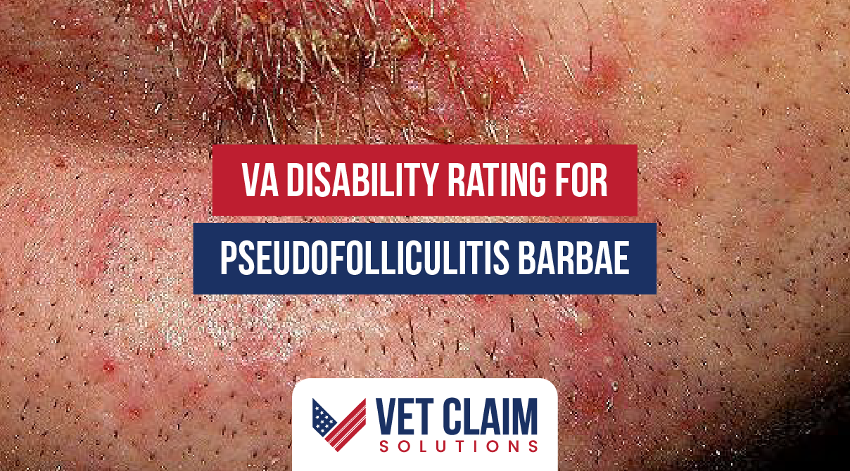 VA Rating for Pseudofolliculitis Barbae